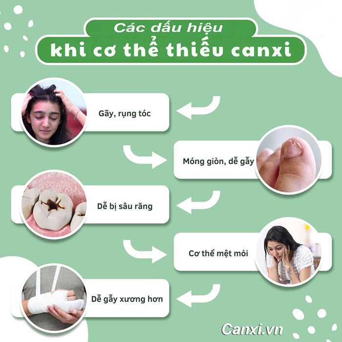 Các dấu hiệu thiếu canxi phổ biến thường gặp